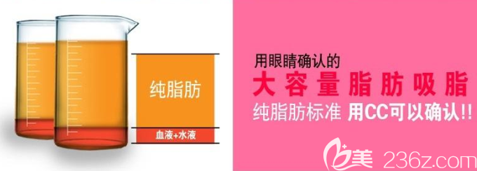 韩国维摩吸脂手术