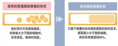 韩国维摩纳米脂肪精雕