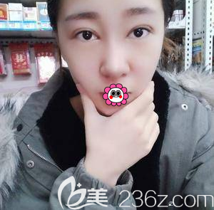 北京画美眼综合<span style= 北京画美眼综合<span style=