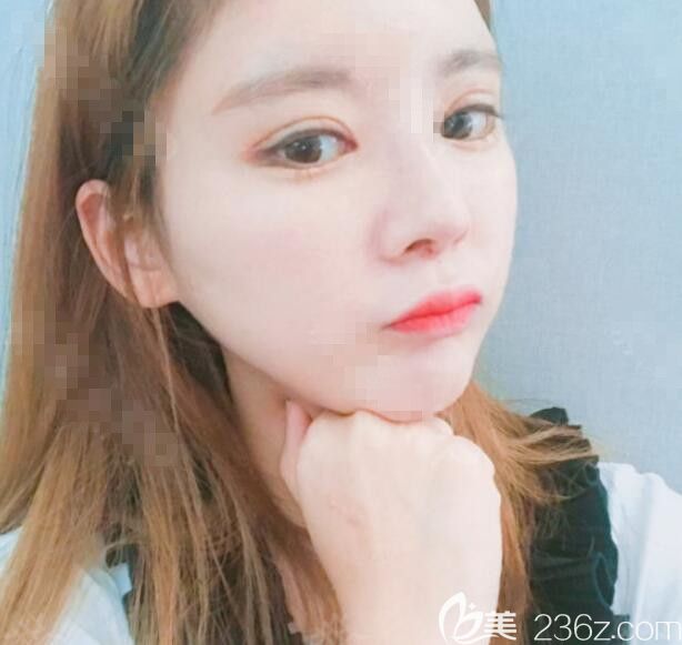 韩国佳轮韩整形医院做轮廓怎么样 韩国佳轮韩整形医院做轮廓怎么样