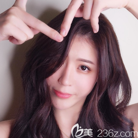 广州中家医家庭医院朱云做双眼皮隆鼻怎么样