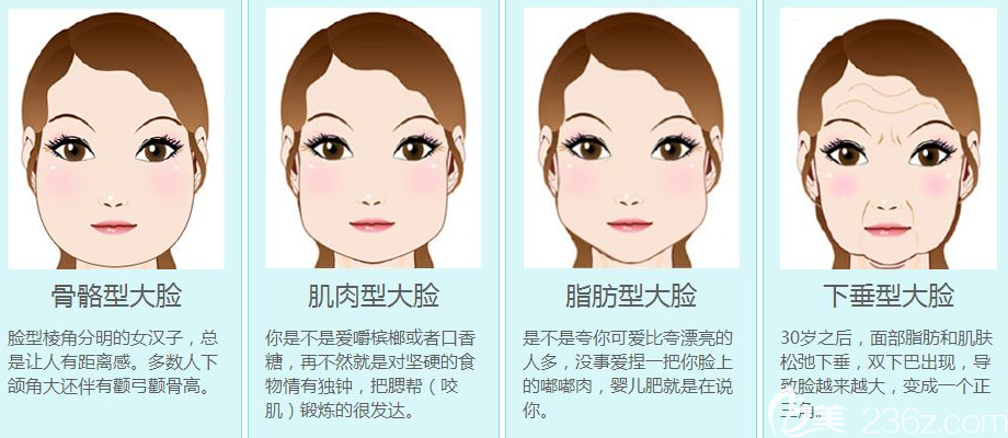 面部轮廓整形医生金洞河讲大脸的分类 面部轮廓整形医生金洞河讲大脸的分类