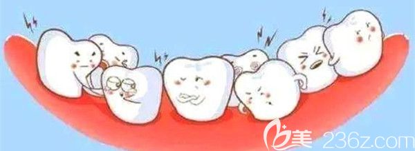 错过黄金矫正器,成年人矫正不限制年龄 错过黄金矫正器,成年人矫正不限制年龄