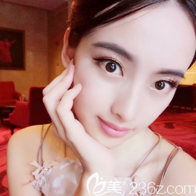 <!--<i data=20240703-sp></i>-->医院<!--<i data=20240703-sp></i>-->做的全脸自体脂肪填充案例 <!--<i data=20240703-sp></i>-->医院<!--<i data=20240703-sp></i>-->做的全脸自体脂肪填充案例