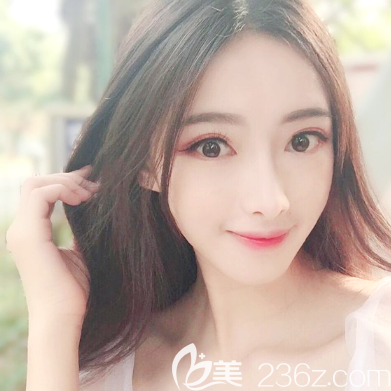 <!--<i data=20240703-sp></i>-->医院面部脂肪填充术后一个月 <!--<i data=20240703-sp></i>-->医院面部脂肪填充术后一个月