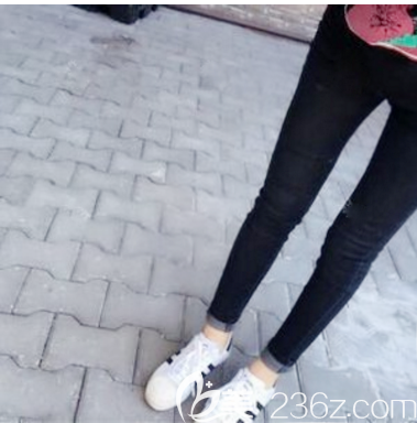 <!--<i data=20240703-sp></i>-->医院<!--<i data=20240703-sp></i>-->医生大腿吸脂案例 <!--<i data=20240703-sp></i>-->医院<!--<i data=20240703-sp></i>-->医生大腿吸脂案例