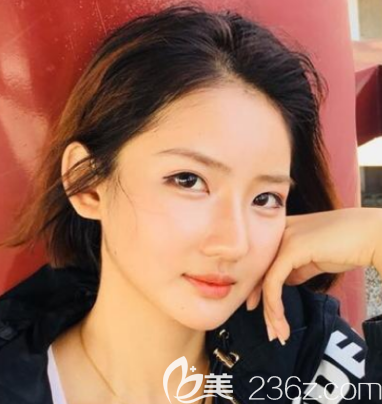 做过拉皮手术后悔要死,看我去韩国拉菲安整形做自体脂肪面部填充+拉皮手术对比照片