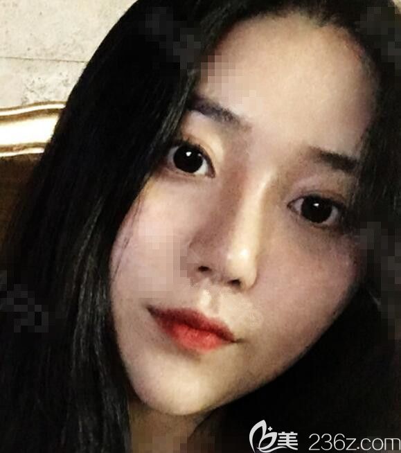 韩国维摩姜在九做的吸脂加脂肪填充他们都说不相信是假的