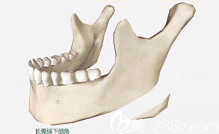 长曲线下颌角示意图