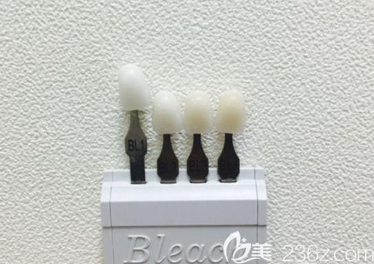 瓷贴面颜色 瓷贴面颜色