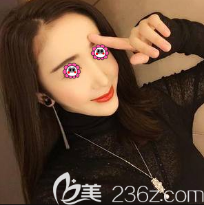 马群医生给我做鼻修复第32天<span style= 马群医生给我做鼻修复第32天<span style=