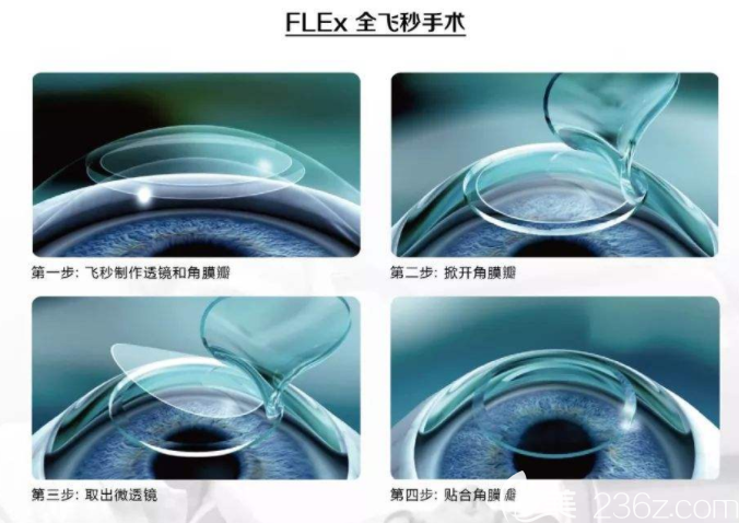 激光近视手术3年后亲身经历告诉你危害及