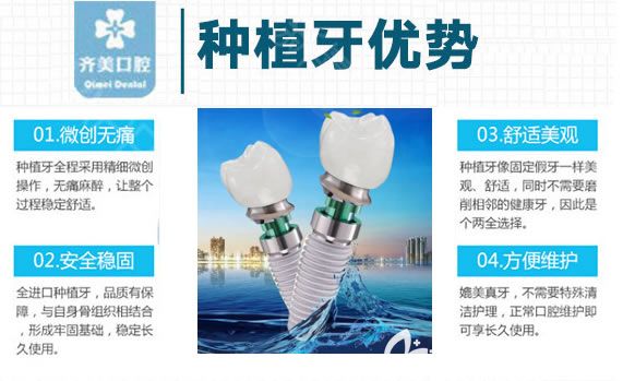 重庆齐美口腔高精3D导板种植牙技术优势