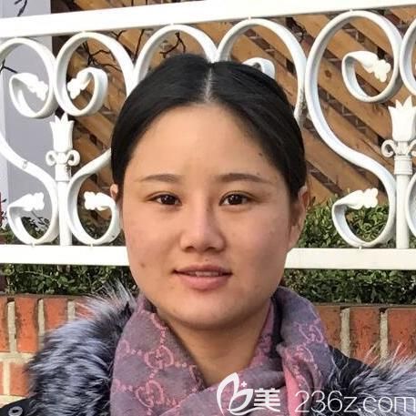 韩国绮林面部轮廓整形真人案例 韩国绮林面部轮廓整形真人案例