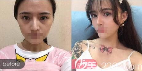 洛阳华美田会建美容护肤前后对比案例