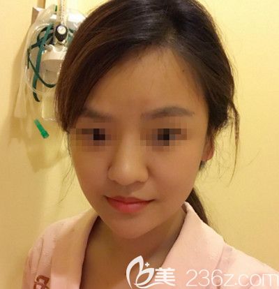 在韩国博朗温做鼻综合手术前 在韩国博朗温做鼻综合手术前