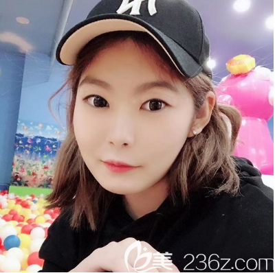 去湛<!--<i data=20240703-sp></i>-->美做双眼皮前的样子 去湛<!--<i data=20240703-sp></i>-->美做双眼皮前的样子