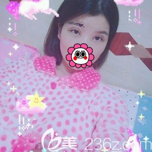 术后一周拆线眼部整形恢复 术后一周拆线眼部整形恢复