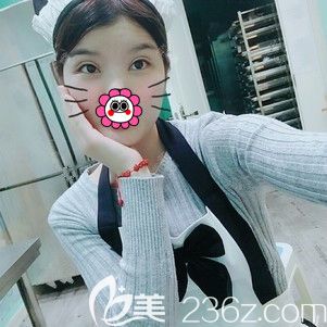 双眼皮+开眼角术后半个月恢复 双眼皮+开眼角术后半个月恢复