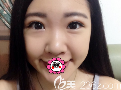 北京新星靓眼综合 北京新星靓眼综合