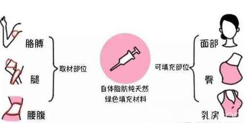 自体脂肪移植填充原理 自体脂肪移植填充原理