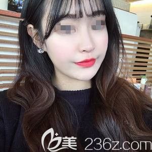 疯狂打call常州美贝尔微整医生 仅用了100单位国产兰州就改变了我19年的嘟嘟脸