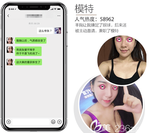 个别爱美者在北京长虹做了假体丰胸后的口碑评价展示