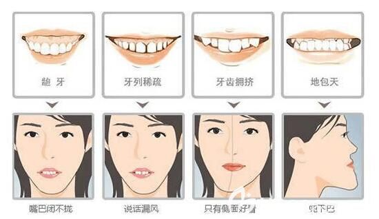 南京博韵口腔许辰林医生牙齿矫正图 南京博韵口腔许辰林医生牙齿矫正图