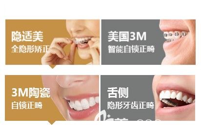 隐适美隐形牙套和3m陶瓷牙套的优势 隐适美隐形牙套和3m陶瓷牙套的优势