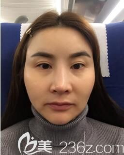 术前的我 术前的我