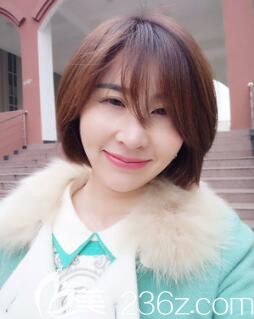 胡煜面部线雕术后1个月 胡煜面部线雕术后1个月