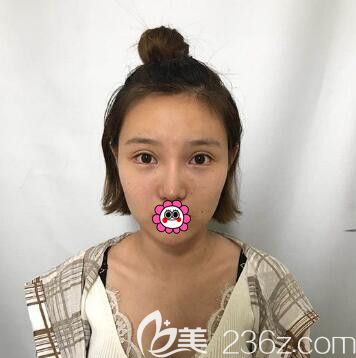 在沈阳<span style= 在沈阳<span style=