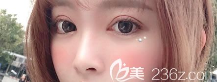 宁波薇琳雷艳莉双眼皮<span style= 宁波薇琳雷艳莉双眼皮<span style=