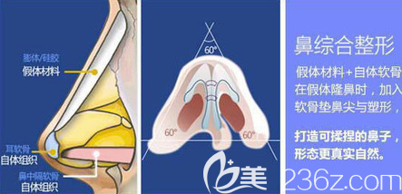鼻综合示意图 鼻综合示意图