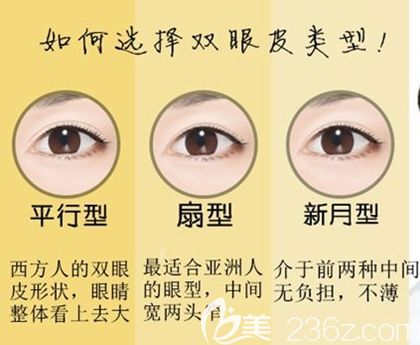 韩国MVP眼部整形类型 韩国MVP眼部整形类型