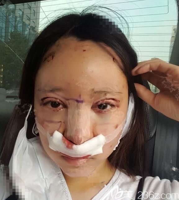 术后<span style= 术后<span style=