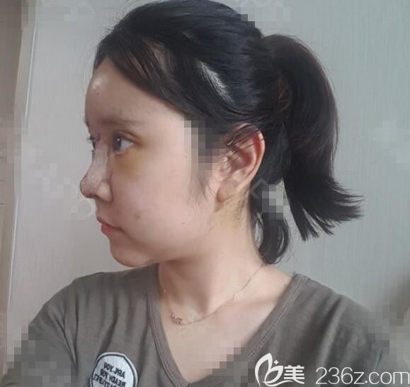 刚做完手术 刚做完手术