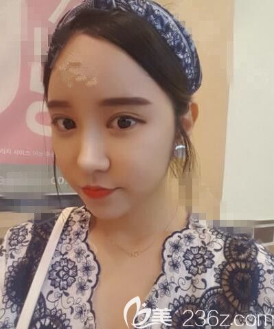 韩国德丽珍整形医院那个院长做鼻子好 韩国德丽珍整形医院那个院长做鼻子好