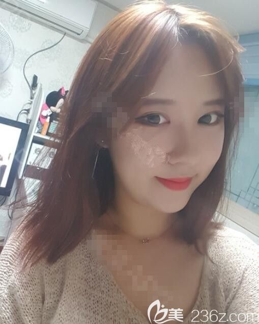 韩国德丽珍整形医院眼鼻真人<span style= 韩国德丽珍整形医院眼鼻真人<span style=