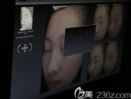 我在北京艺星祛斑前做皮肤检测 我在北京艺星祛斑前做皮肤检测