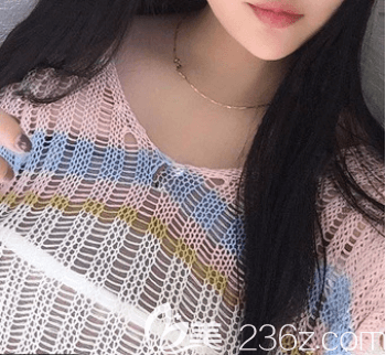 在北京新星靓做蓓拉假体隆胸前样子 在北京新星靓做蓓拉假体隆胸前样子