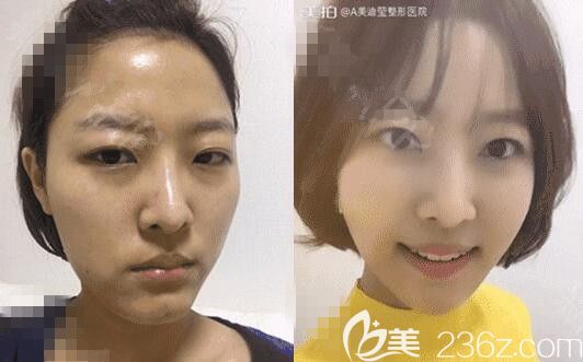 韩国美迪莹徐范信轮廓怎么样 韩国美迪莹徐范信轮廓怎么样