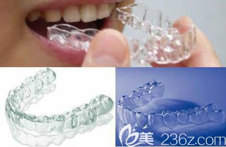 牙套的种类和价格请看湛江致美口腔正畸医生<!--<i data=20240703-sp></i>-->宏解答 牙套的种类和价格请看湛江致美口腔正畸医生<!--<i data=20240703-sp></i>-->宏解答