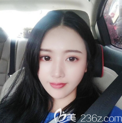 广州荔医邹顺禄做的脂肪填充效果怎么样 广州荔医邹顺禄做的脂肪填充效果怎么样