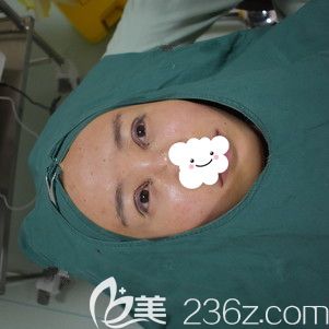 刚做完眼综合术后效果分享
