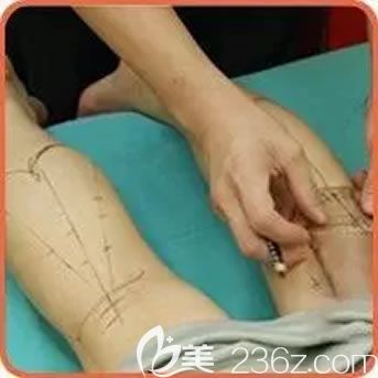 注射瘦腿前的设计过程