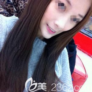 面颊消瘦面诊常州美贝尔医生 面颊消瘦面诊常州美贝尔医生