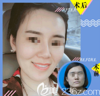 20190530_1559211818500329.png blob.png