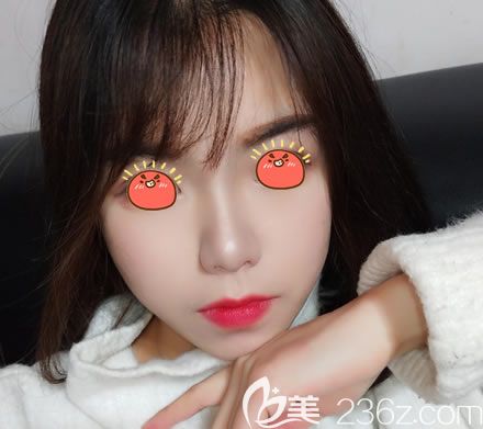 绍兴维美整形医院岳辉祛斑案例 绍兴维美整形医院岳辉祛斑案例