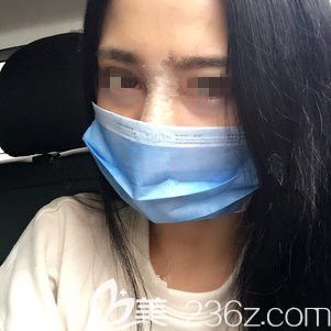 刚做完硅胶隆鼻术后即刻 刚做完硅胶隆鼻术后即刻